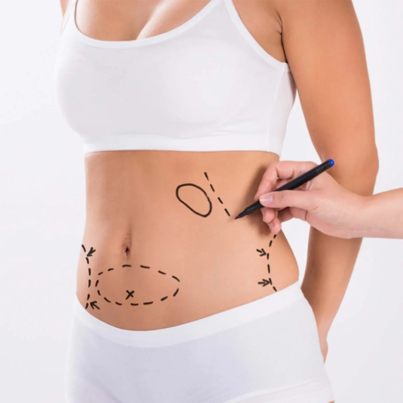 Lipo Fat